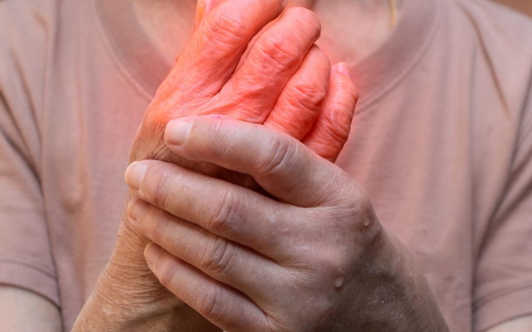 Waarom heet koudschuim koudschuim?